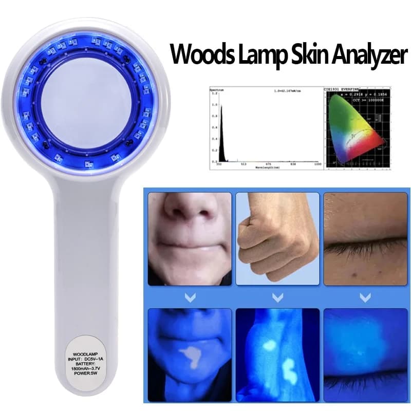 Nueva lámpara de madera, analizador de piel, analizador de belleza Facial portátil, lámpara UV, Dermatología de madera para análisis de examen de prueba